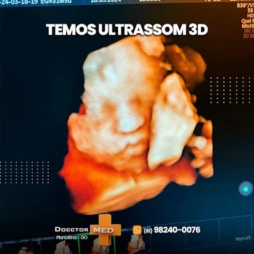 Ultrassom 3D